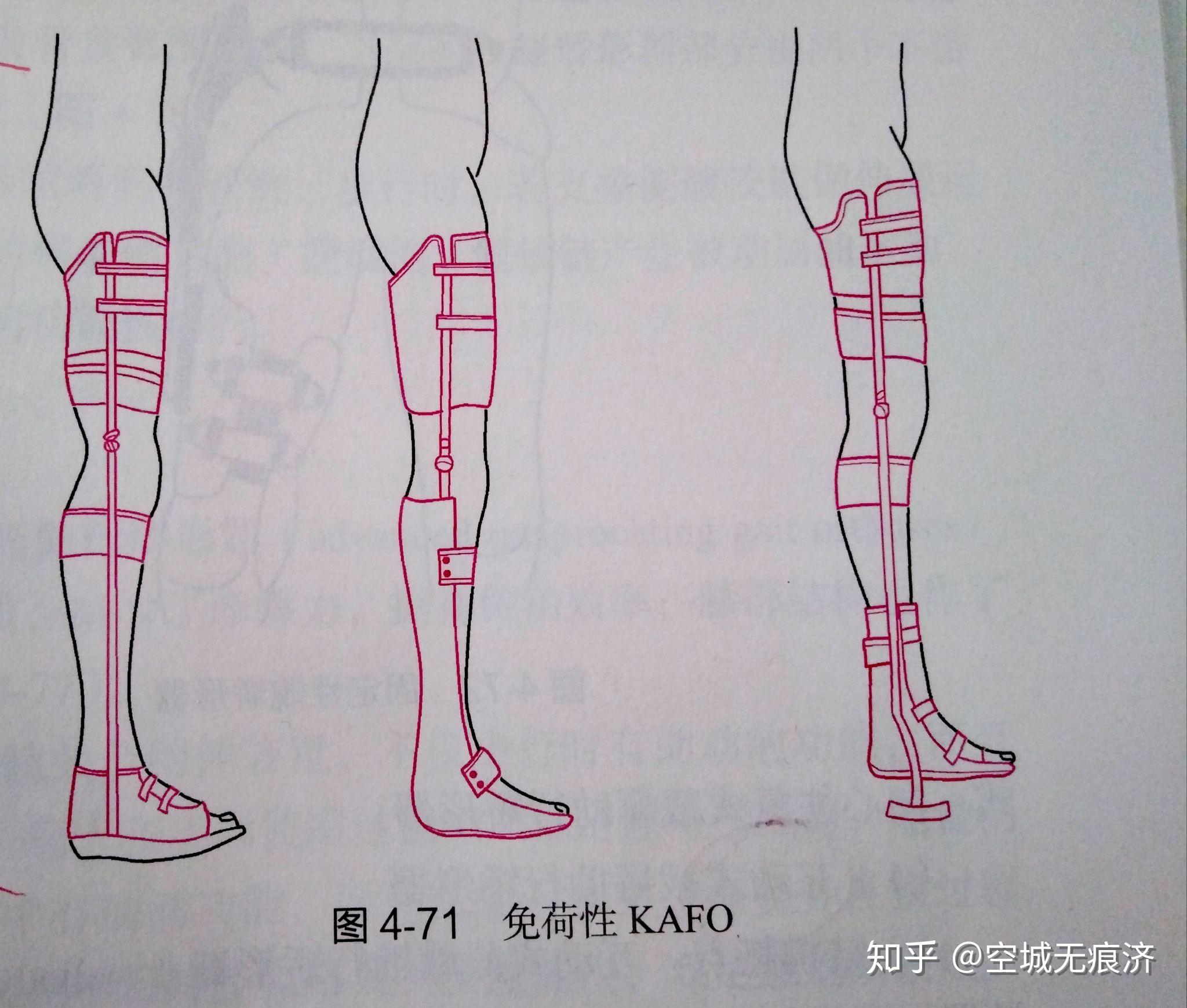 臨床康復工程學 假肢與矯形器的功能、設計與發(fā)展